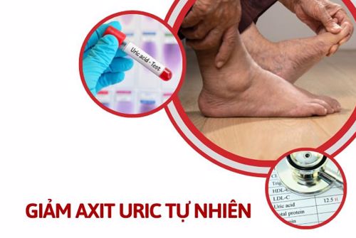 9 Cách giảm axit uric tự nhiên cho hiệu quả tốt nhất